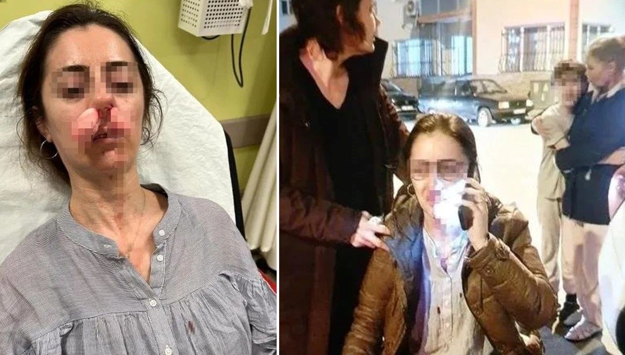 otomobil kapisi silah sayildi esinin sevgilisisandi arabanin kapisiyla saldirdi iFakMRsM